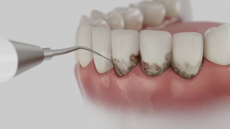 Trusted Dental Implants service in Reisterstown, MD - Dentist Open Now